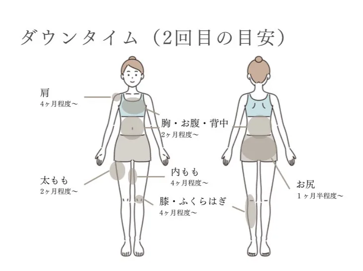 ダウンタイムが少なく日常生活への影響を最小限に抑える